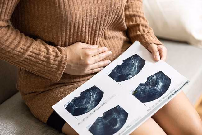 Faktor Risiko Kanker Serviks Wajib Diketahui Setiap Perempuan