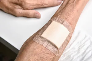 Panduan Merawat Luka Pada Penderita Diabetes Agar Tetap Aman