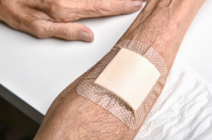 Panduan Merawat Luka Pada Penderita Diabetes Agar Tetap Aman